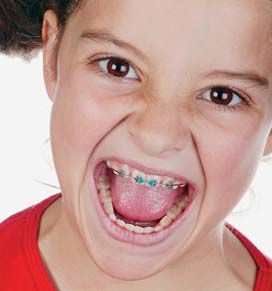 Poorter tandartsen: beugel / orthodontist